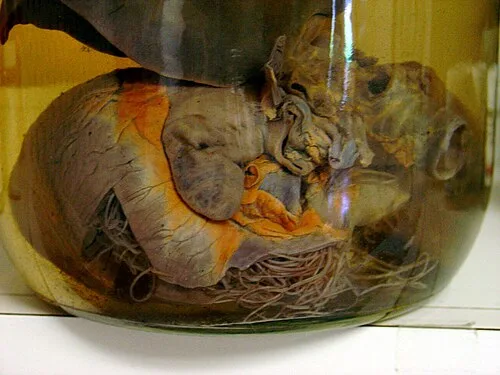 Heartworms