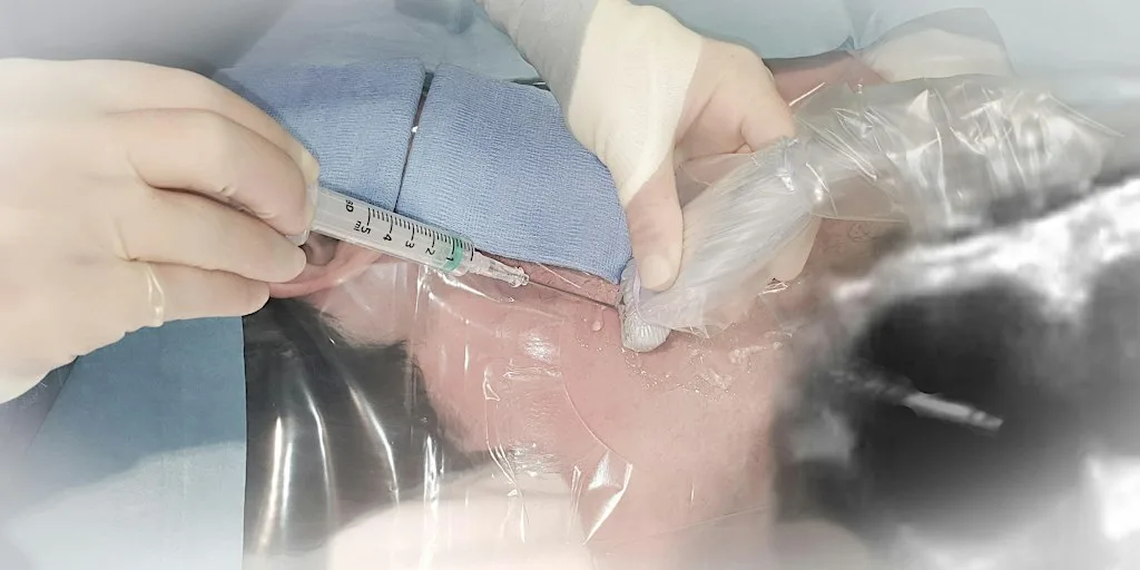 RBH Ultrasound Vascular Access Workshop at Clinical Skills and Simulation Centre (CSSC) Royal Brompton Hospital