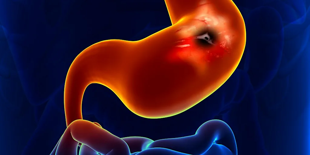 Advanced Endoscopy Series -ERCP at ASSERT Centre
