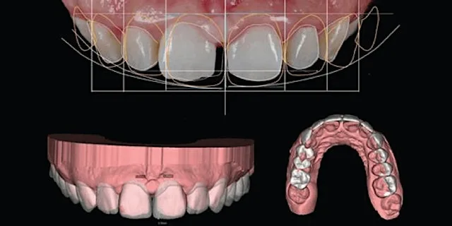 Study Circle - Dental Restorative Level 3