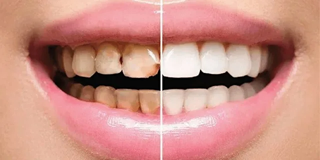 Study Circle - Dental Restorative Level 4 at SynTrain International Academy