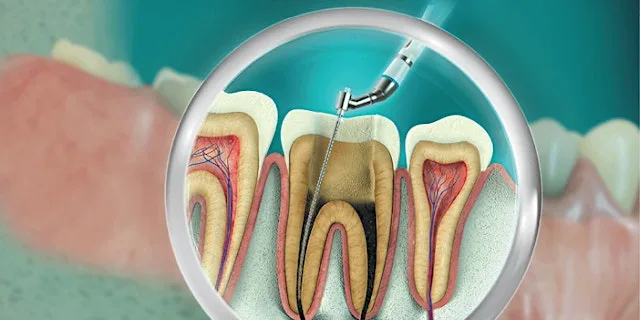 Study Circle - Endodontics & Rubber Dam Masterclass
