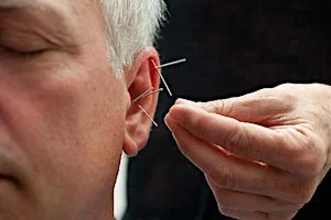 Lunchtime Treatment: Community Ear Acupuncture at 4 Barnfield Cres