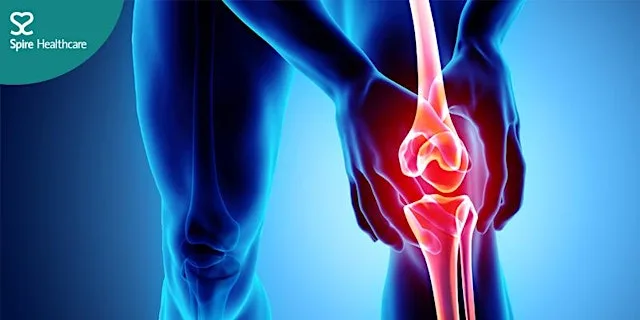 Advances in knee replacement: improving precision and recovery at Spire Cardiff Hospital