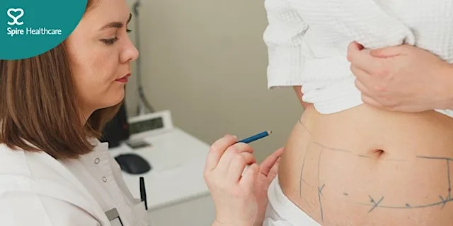 Spire Alexandra - Beyond weight loss: Restoring your shape and confidence at Spire Alexandra Hospital