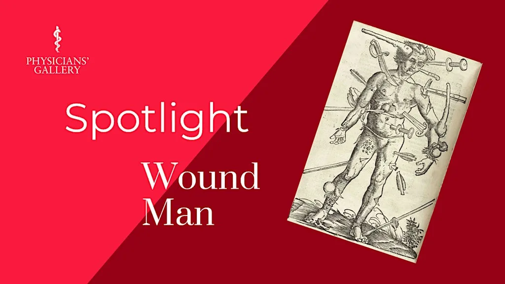 Spotlight: Wound Man at Physicians' Gallery