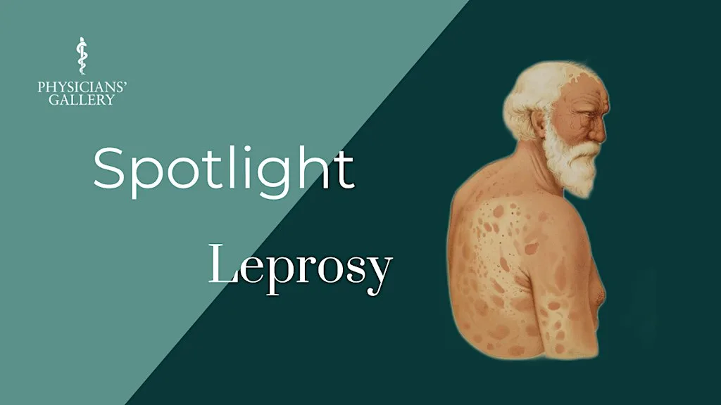 Spotlight: Leprosy at Physicians' Gallery