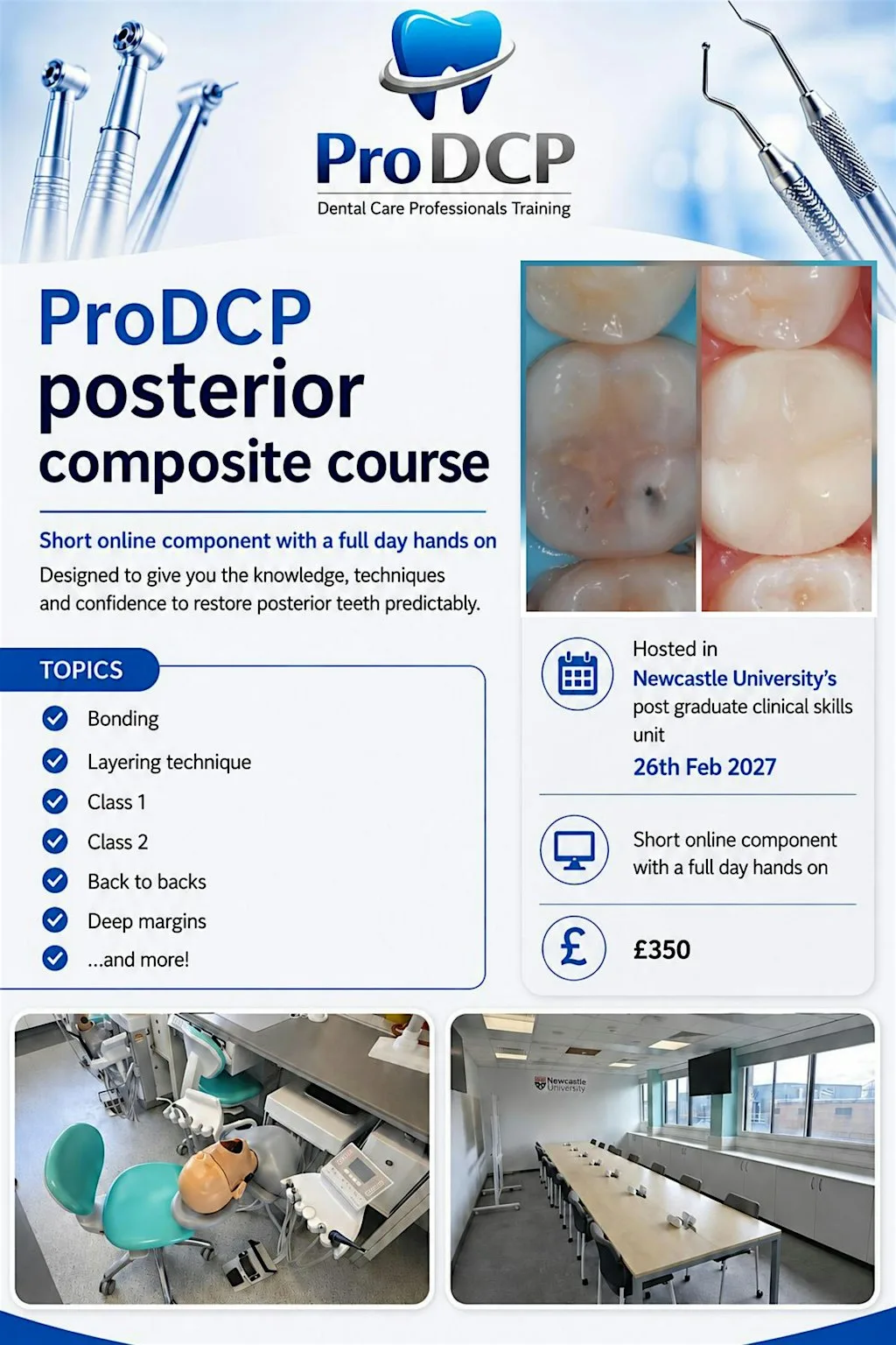 ProDCP Posterior Composites