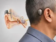 BONE CONDUCTION SURGICAL TRAINING LAB at ASSERT Centre