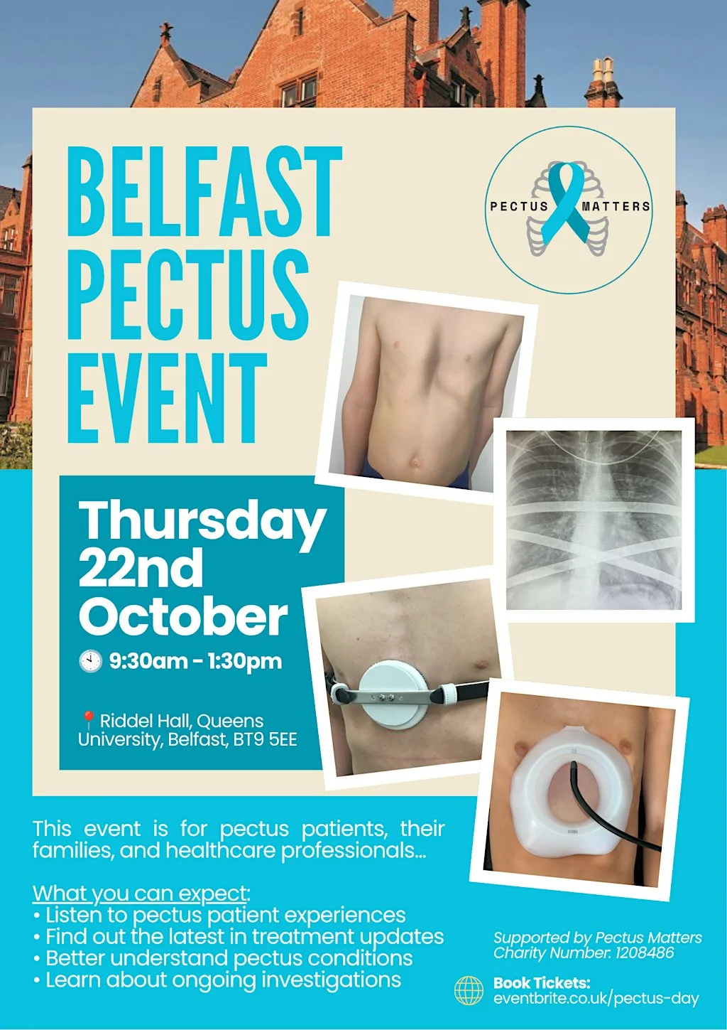 Pectus Day