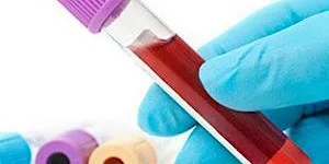 Phlebotomy (Venepuncture) Training - In Person - NEWCASTLE (ACCREDITED) at Metropolitan House