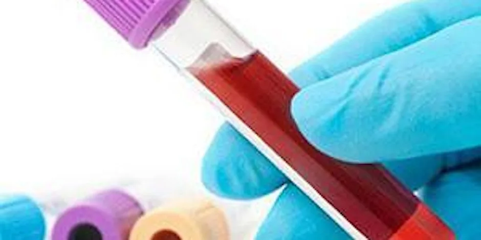 Phlebotomy (Venepuncture) Training - In Person - NEWCASTLE at Metropolitan House