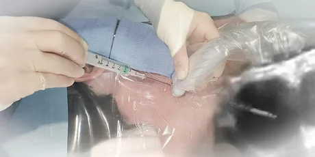 RBH Ultrasound Vascular Access Workshop