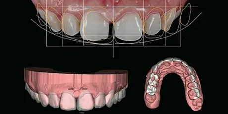 Study Circle - Dental Restorative Level 3