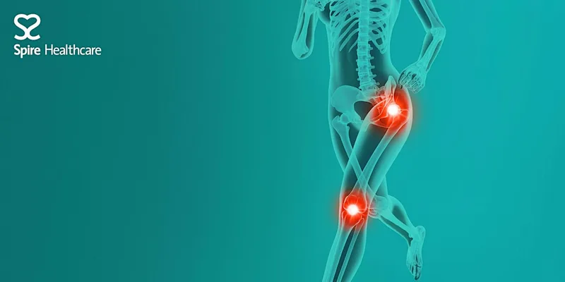 Free hip and knee pain information evening with Mr Chris Wakeling