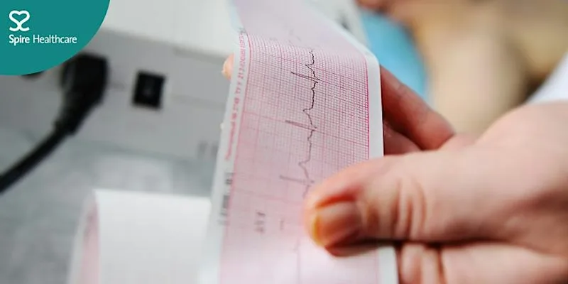 Free event: Caring for Your Heart: Understanding Common Cardiac Conditions