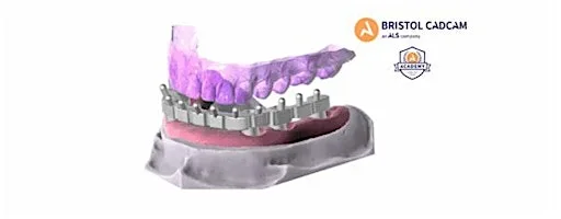 Exocad Basic Crown and Bridge