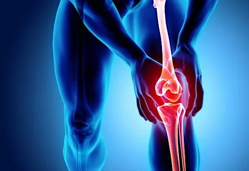 Knee Pain & Arthritis Patient Information Evening